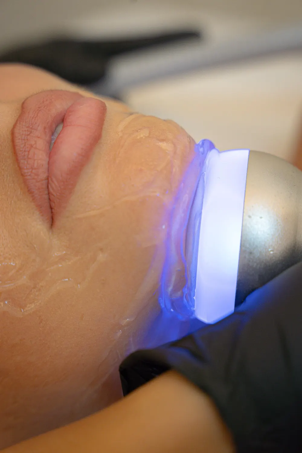 Soin Cryo Face : applicateur froid posé sur le visage